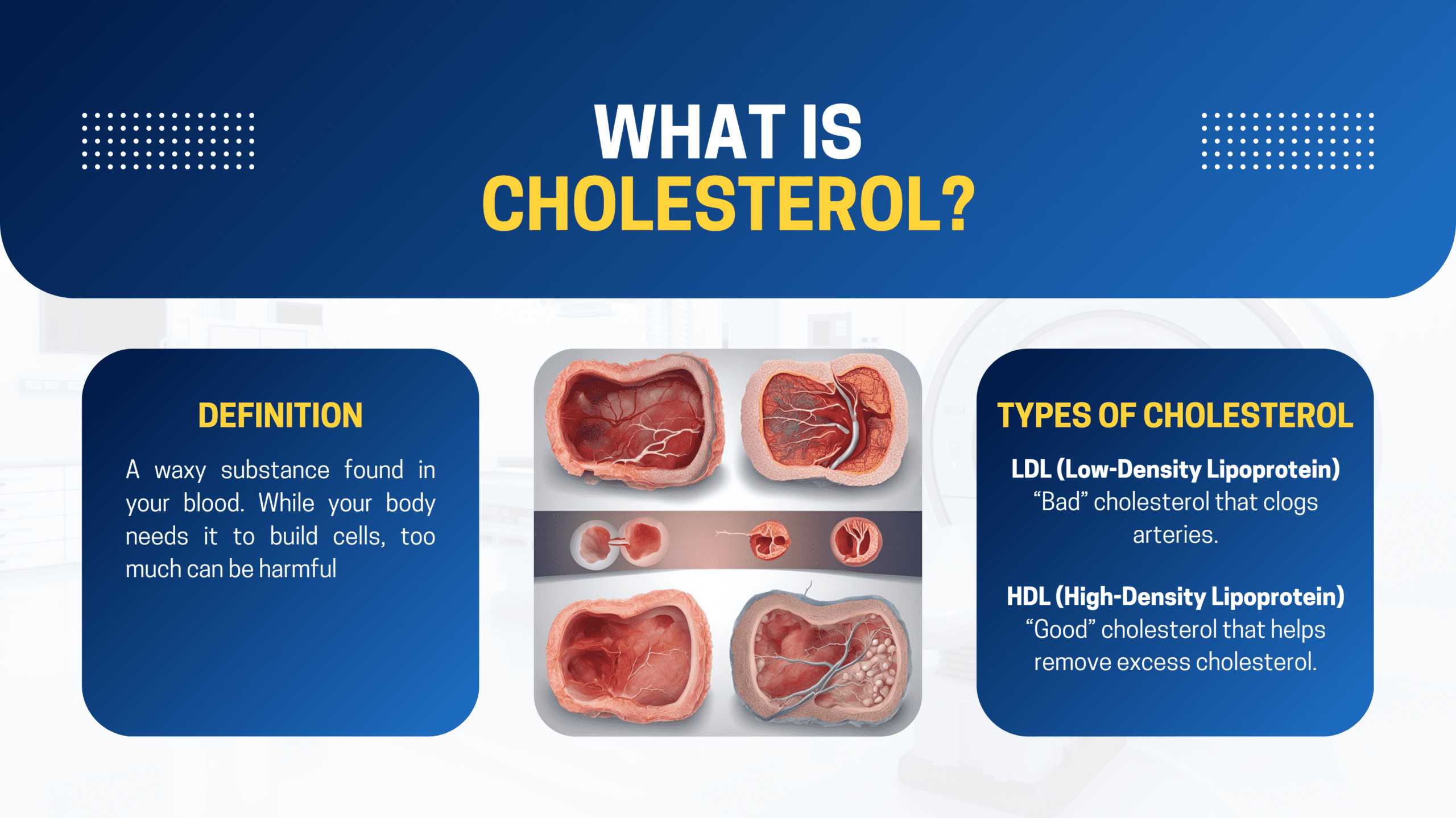 Diagram showing LDL and HDL cholesterol types.